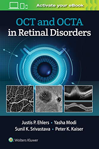 OCT and OCT Angiography in Retinal Disorders (ePub)