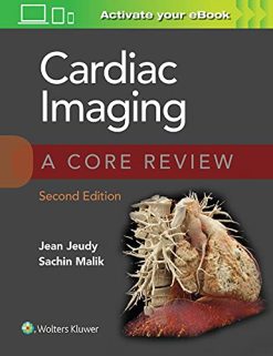 Cardiac Imaging: A Core Review, 2nd edition (ePub3+Converted PDF)