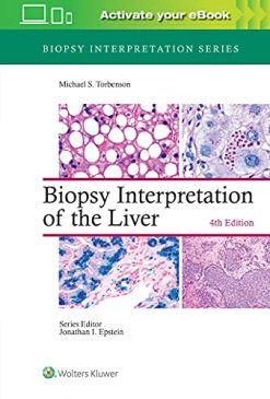 Biopsy Interpretation of the Liver (Biopsy Interpretation Series), 4th Edition (EPUB3 + Converted PDF)