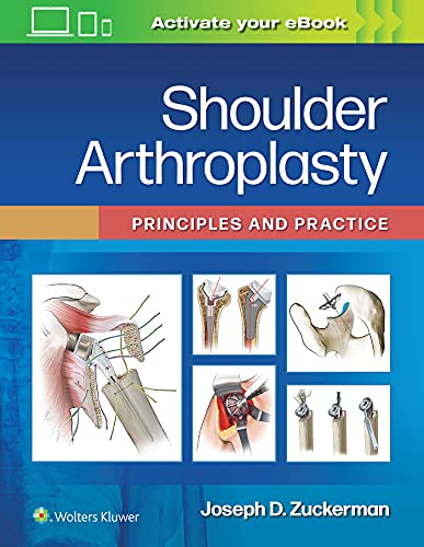 Shoulder Arthroplasty: Principles and Practice (ePub3+Converted PDF)