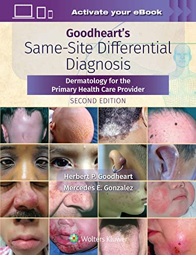 Goodheart’s Same-Site Differential Diagnosis: Dermatology for the Primary Health Care Provider, Second Edition (EPUB)