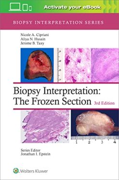 Biopsy Interpretation: The Frozen Section, 3rd Edition (Biopsy Interpretation Series) (EPUB)