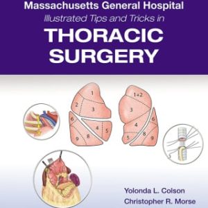 Massachusetts General Hospital Illustrated Tips and Tricks in Thoracic Surgery (EPUB)