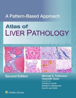 Atlas of Liver Pathology: A Pattern-Based Approach, 2nd Edition (EPUB)
