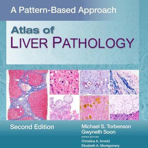 Atlas of Liver Pathology: A Pattern-Based Approach, 2nd Edition (EPUB)