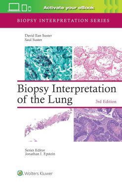 Biopsy Interpretation of the Lung (Biopsy Interpretation Series) (EPUB)