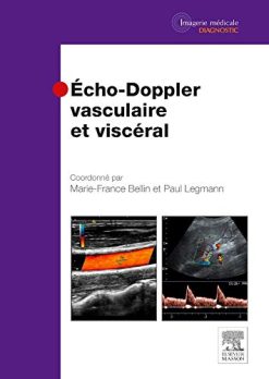 Echo-doppler Vasculaire Et Viscéral (French Edition) (Original PDF from Publisher)