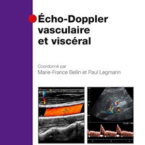Echo-doppler Vasculaire Et Viscéral (French Edition) (Original PDF from Publisher)