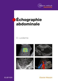 Echographie Abdominale (Imagerie Medicale Diagnostic) (French Edition) (Original PDF from Publisher)