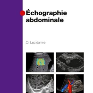 Echographie Abdominale (Imagerie Medicale Diagnostic) (French Edition) (Original PDF from Publisher)
