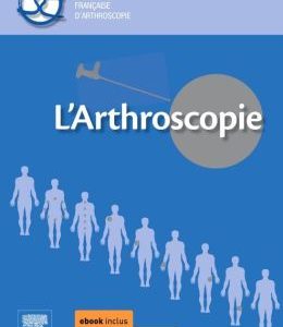 L’arthroscopie (PDF)