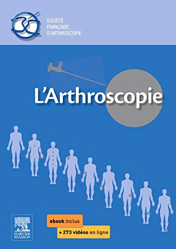 L’arthroscopie (Hors collection) (French Edition) (Original PDF from Publisher)