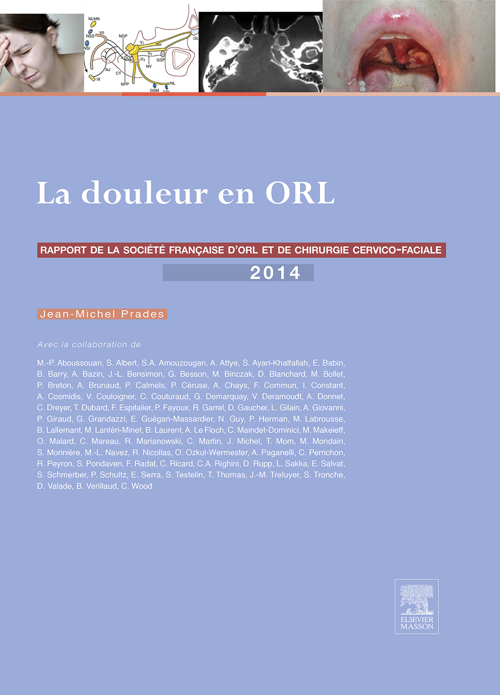 La douleur en ORL: Rapport 2014 de la Société française d’ORL et de chirurgie cervico-faciale (EPUB)