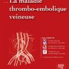 La maladie thrombo-embolique veineuse (Hors collection) (French Edition) (Original PDF from Publisher)