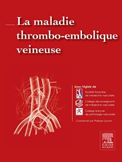 La maladie thrombo-embolique veineuse (Hors collection) (French Edition) (Original PDF from Publisher)