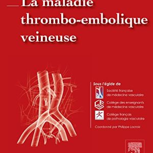 La maladie thrombo-embolique veineuse (Hors collection) (French Edition) (Original PDF from Publisher)