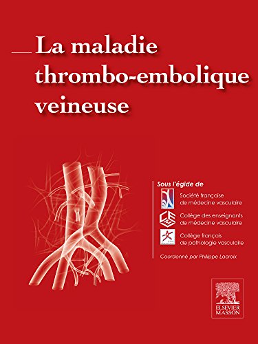 La maladie thrombo-embolique veineuse (Hors collection) (French Edition) (Original PDF from Publisher)