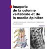 Imagerie De La Colonne Vertébrale Et De La Moelle Épinière (French Edition), 3rd Edition (PDF)