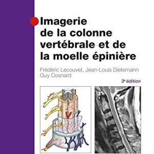 Imagerie De La Colonne Vertébrale Et De La Moelle Épinière (French Edition), 3rd Edition (PDF)