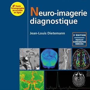 Neuro-imagerie diagnostique, 3e (Original PDF from Publisher)