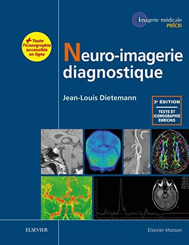 Neuro-imagerie diagnostique, 3e (Original PDF from Publisher)