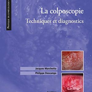 La colposcopie: Techniques et diagnostics, 4th edition (True PDF)