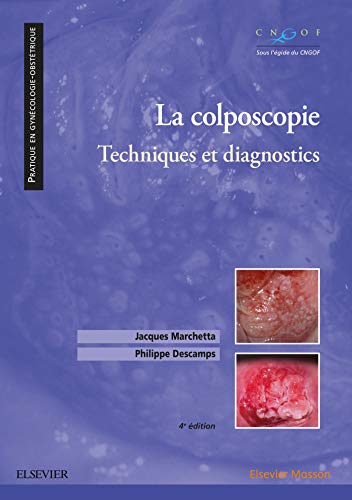 La colposcopie: Techniques et diagnostics, 4th edition (True PDF)