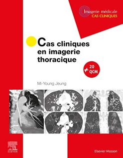 Cas cliniques en imagerie thoracique (French Edition) (EPUB)