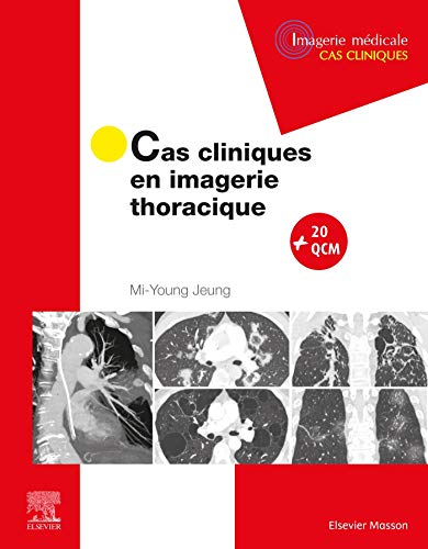 Cas cliniques en imagerie thoracique (French Edition) (EPUB)