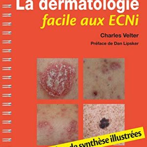 La dermatologie facile aux ECNi: Fiches de synthèse illustrées (Original PDF from Publisher)