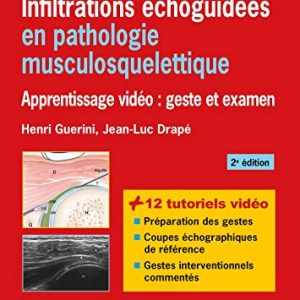 Infiltrations échoguidées en pathologie musculosquelettique: Apprentissage vidéo : geste et examen (Imagerie médicale : pratique) (French Edition) (Original PDF from Publisher)