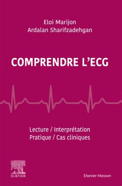 Comprendre l’ECG: Lecture – Interprétation – Pratique – 25 cas cliniques (EPUB)