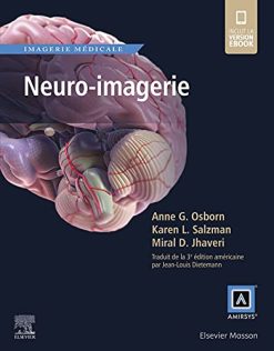 Neuro-imagerie (Réf. en Imagerie Médicale) (French Edition) (EPUB)