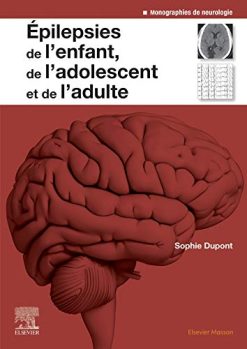 Epilepsies de l’enfant, de l’adolescent et de l’adulte: De la physiopathologie à la prise en charge (Neurologie) (French Edition) (Original PDF from Publisher)