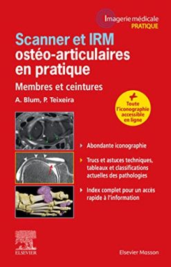 Scanner et IRM ostéo-articulaires en pratique: Membres et ceintures (Original PDF from Publisher)