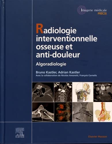 Radiologie Interventionnelle osseuse et anti-douleur: Algoradiologie (Original PDF from Publisher)