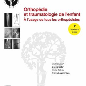 Orthopédie et traumatologie de l’enfant: À l’usage de tous les orthopédistes (EPUB)