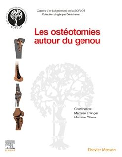 Les ostéotomies autour du genou (Original PDF from Publisher)