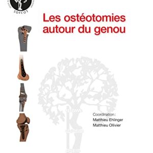 Les ostéotomies autour du genou (Original PDF from Publisher)