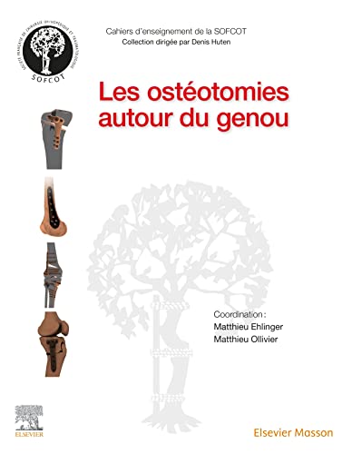 Les ostéotomies autour du genou (Original PDF from Publisher)