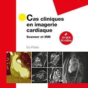 Cas cliniques en imagerie cardiaque: Scanner et IRM (Original PDF from Publisher)