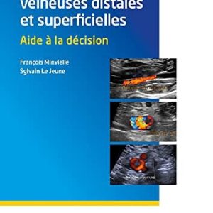 Thromboses veineuses distales et superficielles: Aide à la décision (French Edition) (Original PDF from Publisher)