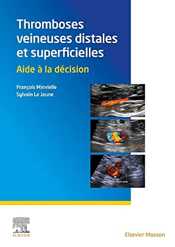 Thromboses veineuses distales et superficielles: Aide à la décision (French Edition) (Original PDF from Publisher)