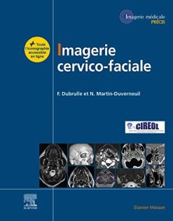 Imagerie cervicofaciale: Massif facial – Sinus – Voies aérodigestives supérieures – Pathologies cervicales – Espaces profonds (Imagerie médicale : Précis) (French Edition) (EPUB)