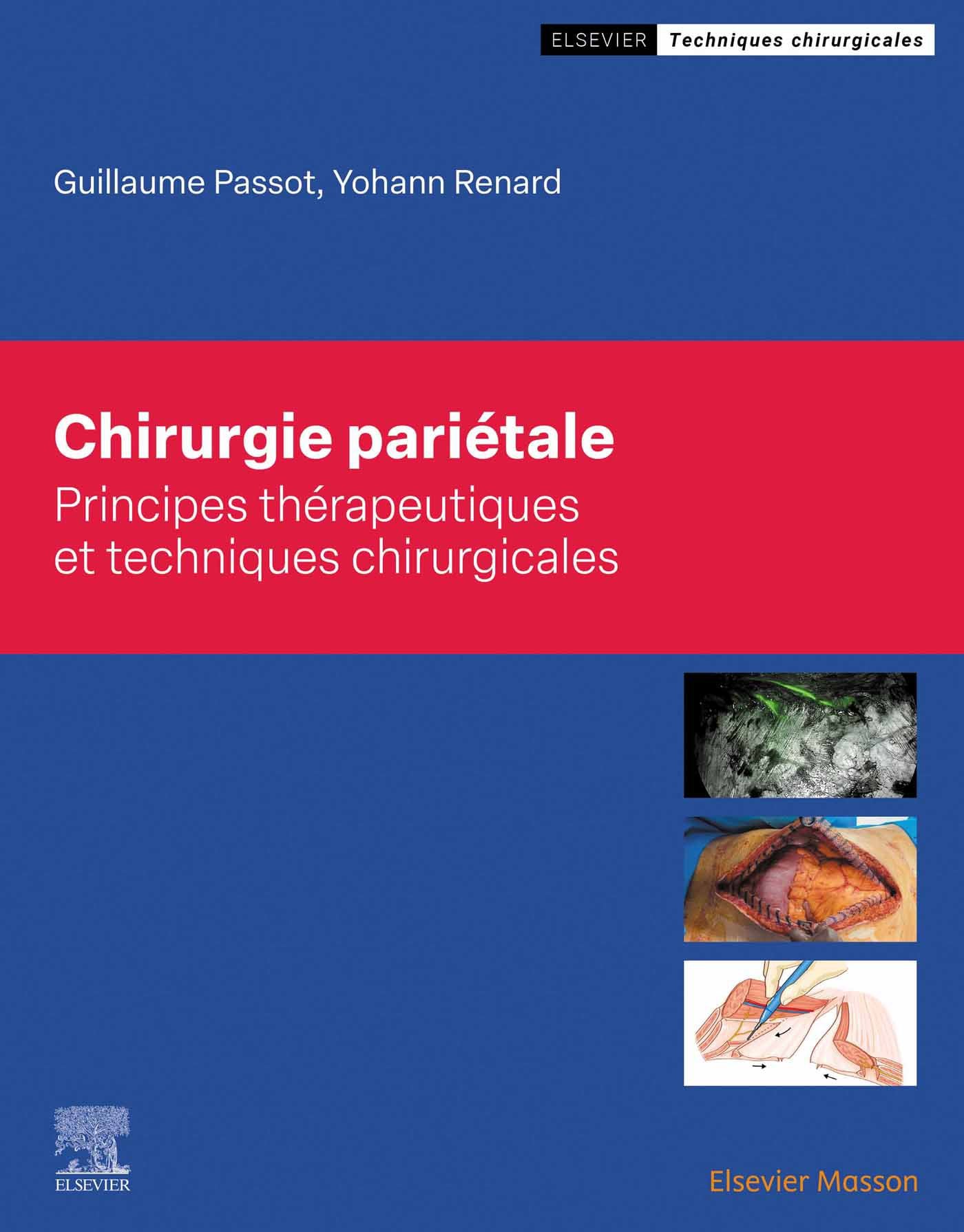 Chirurgie pariétale (Original PDF from Publisher)