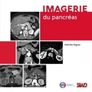 Imagerie du pancréas (Original PDF from Publisher)