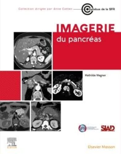 Imagerie du pancréas (Original PDF from Publisher)