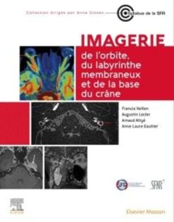 Imagerie de l’orbite, du labyrinthe membraneux et de la base du crâne (Original PDF from Publisher)