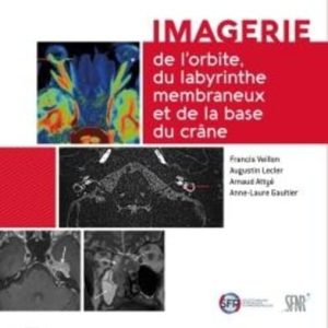 Imagerie de l’orbite, du labyrinthe membraneux et de la base du crâne (Original PDF from Publisher)
