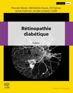 Rétinopathie diabétique, 3rd Edition (EPUB)